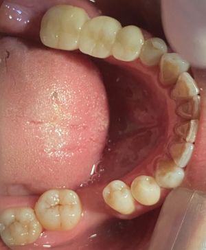 Atención dental personalizada