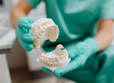 Implantes dentales
