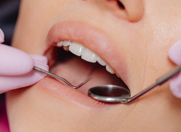 Rehabilitación oral
