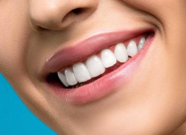 Diseño de sonrisa